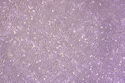 Human poorly differentiated lung adenocarcinoma cells-BNCC