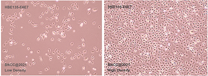 Human bronchial epithelial cells-BNCC