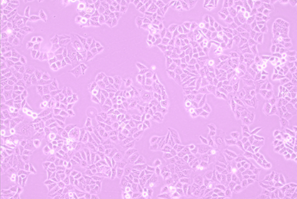 Human hepatoma cells (recognized as contaminated by HELA)-BNCC