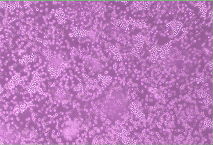 Mouse lymphoma cells-BNCC