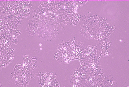 Human pharyngeal squamous cell carcinoma-BNCC