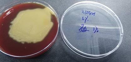 Streptococcus pneumoniae-BNCC