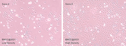 human osteogenic sarcoma cells-BNCC
