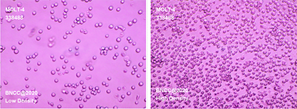 Human acute lymphoblastic leukemia cells-BNCC