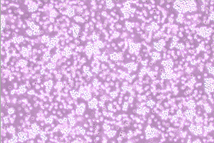 Human acute T-lymphocytic leukemia cells-BNCC