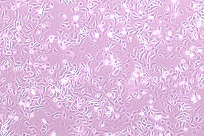 Rat breast cancer cells-BNCC