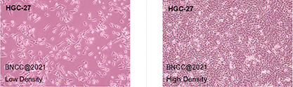 Human gastric cancer cells (undifferentiated)-BNCC
