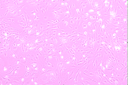 human lymphoendothelial cells-BNCC