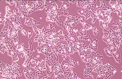 Human adrenocortical adenocarcinoma cells-BNCC