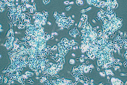 Human colon cancer cells-BNCC