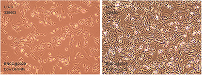 Human glioma cells-BNCC