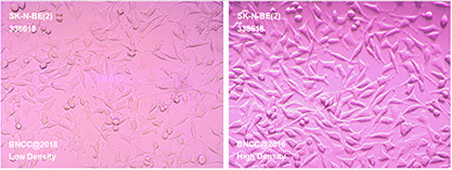 Human neuroblastoma cells-BNCC