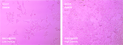 Human teratoma cells-BNCC