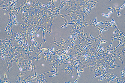 Human ovarian cancer cell-BNCC