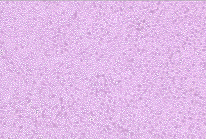 Human pre-B acute lymphoblastic leukemia cells-BNCC