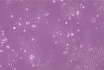 Human normal colon epithelial cells-BNCC