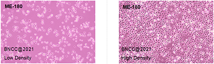 Human cervical epidermal cancer cells-BNCC