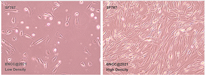 Human brain tumor cells-BNCC