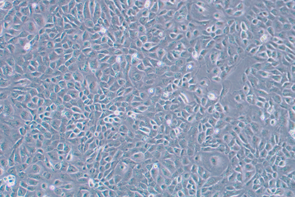 Mouse ovarian cancer cells-BNCC