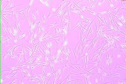 Human brain glioblastoma multiforme cells-BNCC