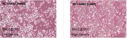 Human cell lung cancer cells-BNCC