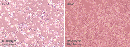 Rat liver cancer cells-BNCC