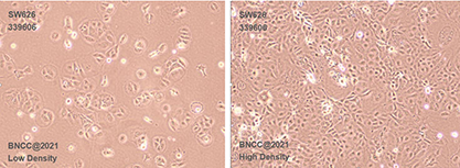 Human ovarian adenocarcinoma cells-BNCC
