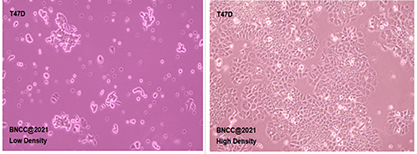 Human breast ductal cancer cells-BNCC