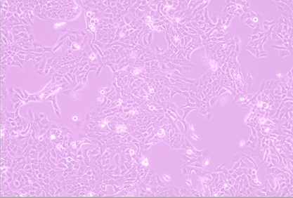 Immortalized human epidermal cells-BNCC