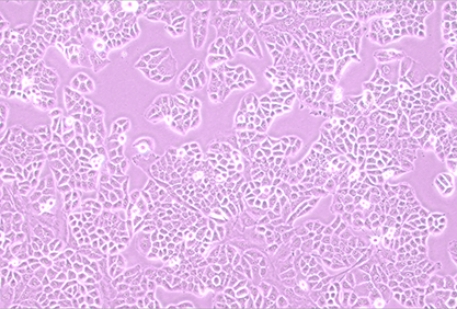 Human esophageal cancer cells (recognized as contaminated by HELA)-BNCC