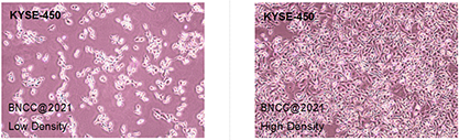 Human esophageal cancer cells-BNCC