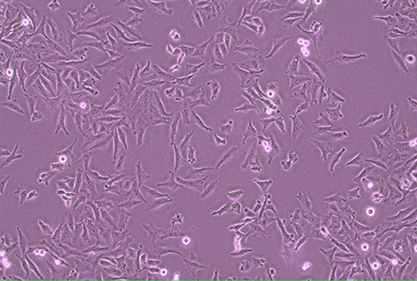 Human endometrial adenocarcinoma (metastatic) cells-BNCC