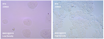 Human bladder transitional cell papilloma cells-BNCC