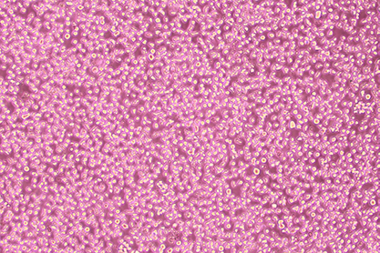 human T lymphocyte cell line-BNCC