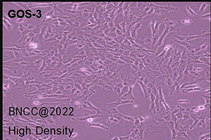 Human glioma cells-BNCC