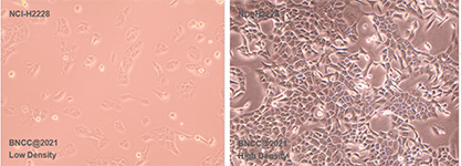 Human non-small cell line lung cancer cells-BNCC