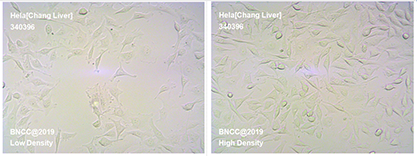 Human cervical cancer cells-BNCC