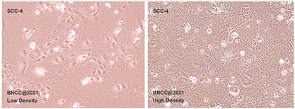 Human tongue squamous cell carcinoma-BNCC