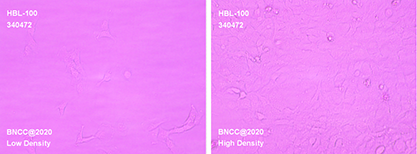 Human Breast Epithelial Cells Integrating SV40 Gene-BNCC