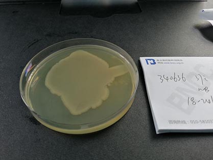 Escherichia coli-BNCC