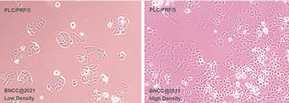 Human Liver Cancer Alexander Cells-BNCC