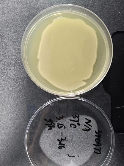 Escherichia coli EPEC-BNCC