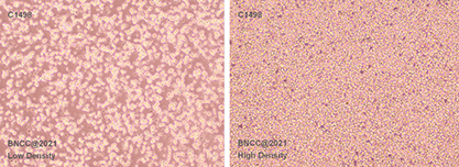 Mouse leukemia cells-BNCC