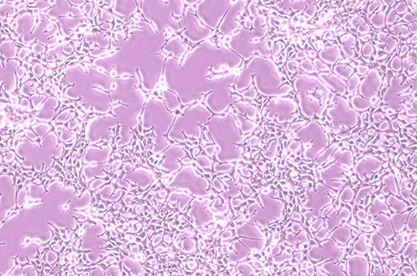 Human embryonic kidney epithelial packaging cells-BNCC