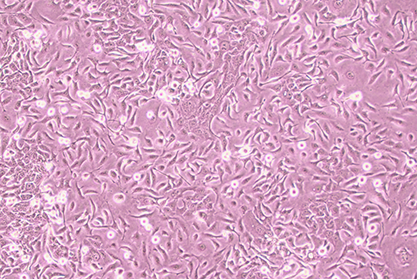 Human pancreatic cancer cells-BNCC