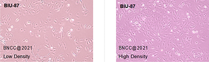 Human bladder cancer cells-BNCC