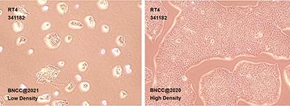 Human bladder transitional cell papilloma cells-BNCC