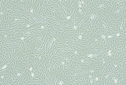 Human glioma cells-BNCC