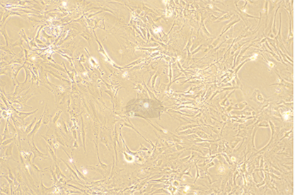 Human glomerular mesangial cells-BNCC