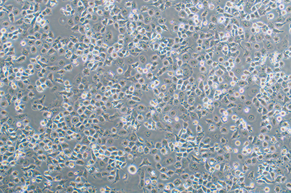 Human non-small cell lung cancer cells-BNCC